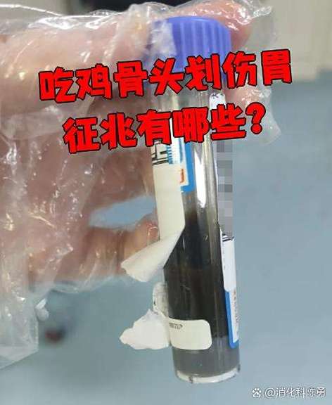 鸡骨头会把肠子划破吗