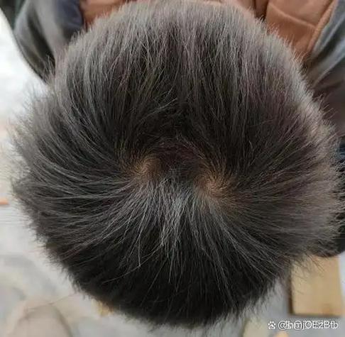 双旋怎么形成的