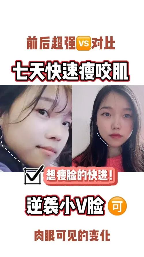 脸部咬肌大怎么瘦下来