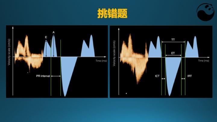 胎儿Tei指数增大截图
