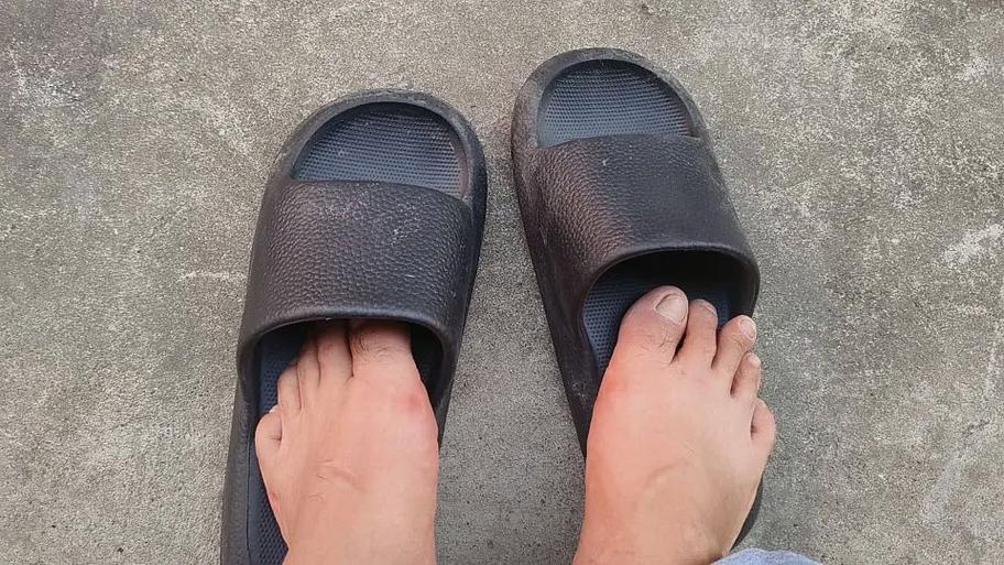 鞋子左右两侧磨脚截图