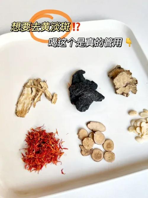 中医内调祛斑有效吗图标