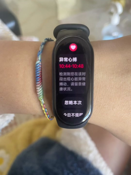 小米手环9看不了微信消息