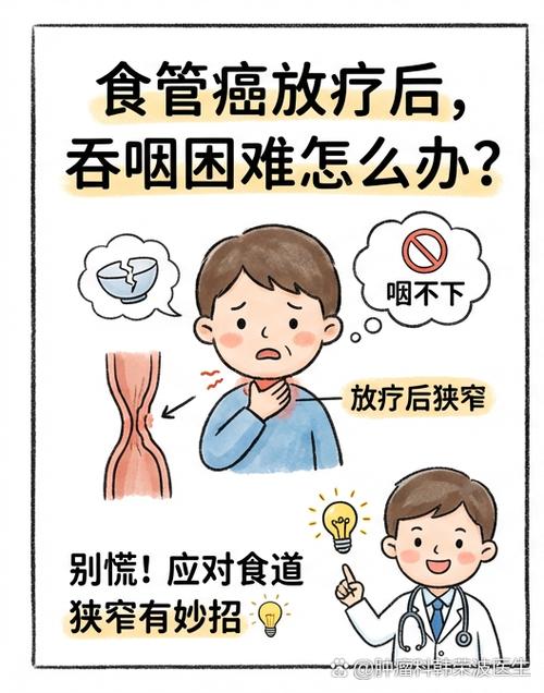 怎样知道食道有没有问题