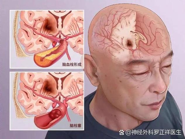 人死前3天的信号