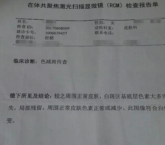 我的手机屏幕出现小白点的原因缩略图