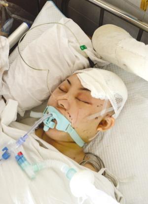 脑死亡是已经去世了吗