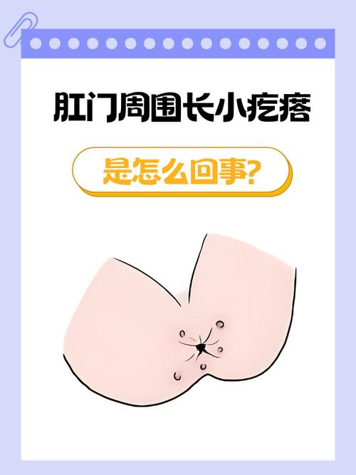 肛门周围长了小肉粒是什么原因