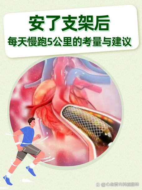 心脏支架后最大的忌讳