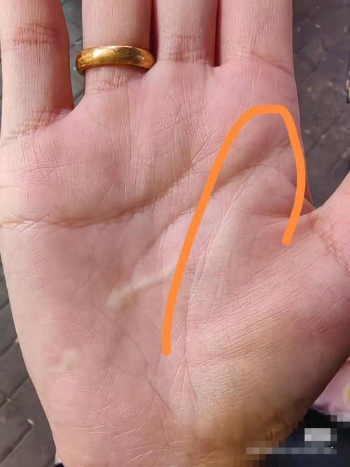有大病的生命线