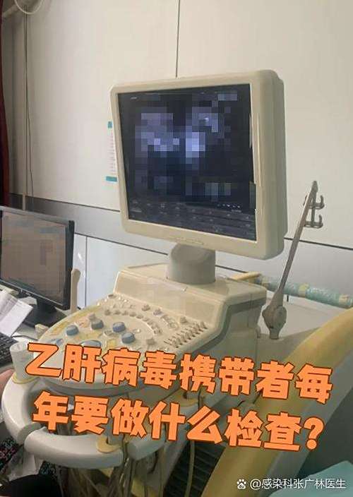 乙肝病毒携带者需要定期做什么检查