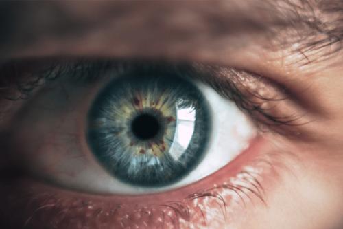 keep a close eye