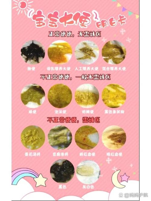 大便图片对照表