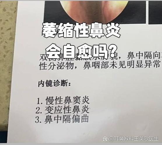 萎缩性鼻炎可用抗生素吗有效果吗