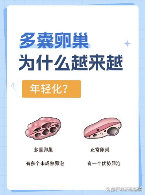 卵巢出问题有哪些症状图标