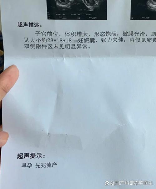 孕55天刚看到暗区