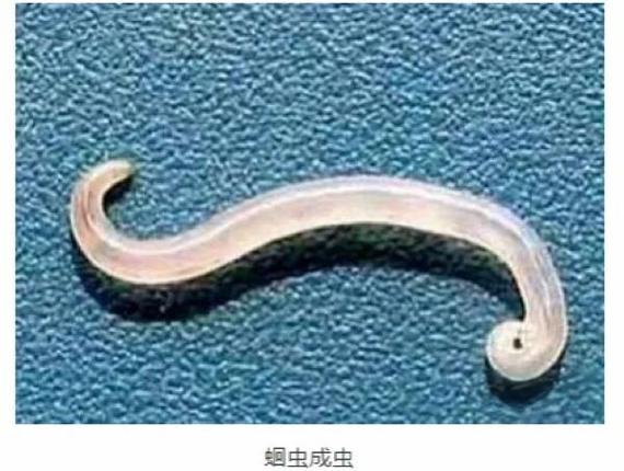 体内寄生虫下载安装