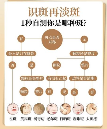 脸上刚做完斑需要怎么修复