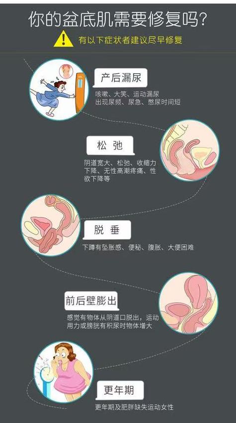 盆底肌恢复正常的表现