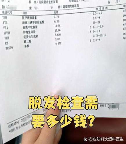 脱发5项检查要多少钱