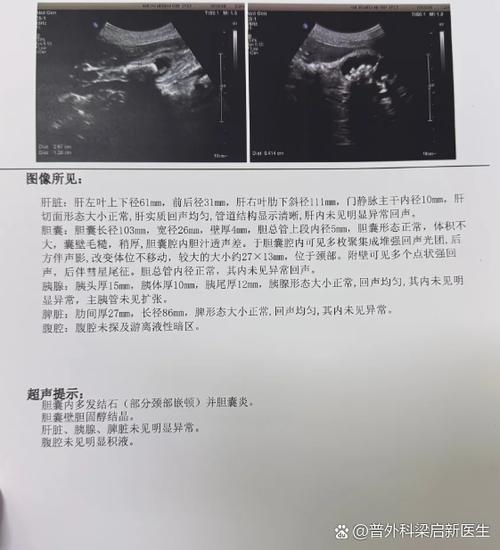 包块暗区