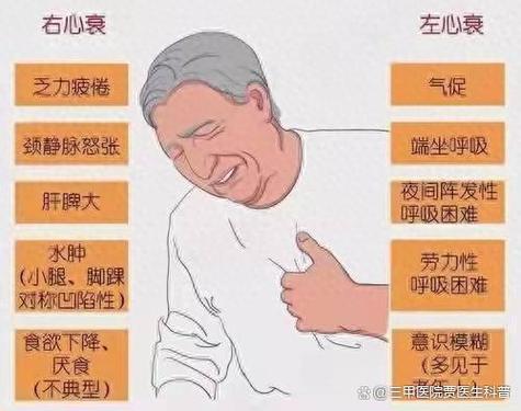 心衰一般寿命多长图标