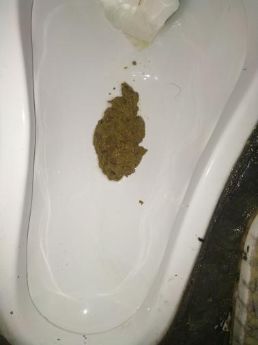 肚子咕噜响大便不成形图标