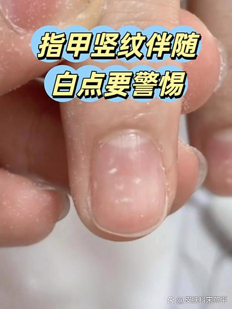 oppo手机出现竖条纹的解决方法