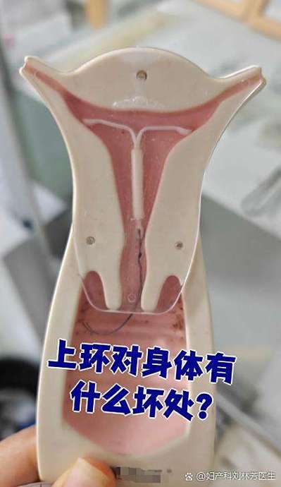 女生戴环的危害和好处