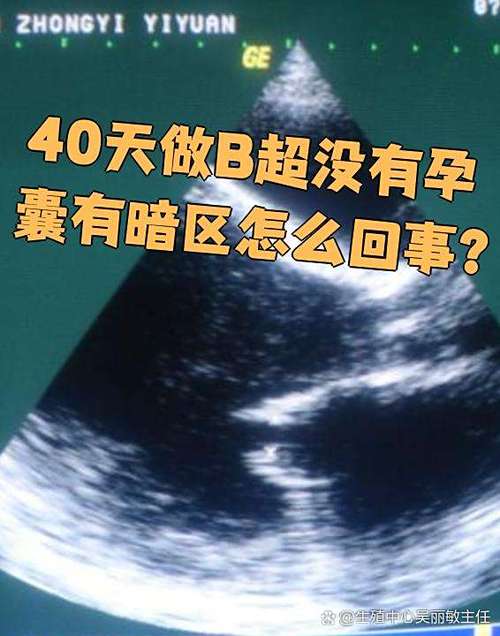 孕40天只看到暗区图标