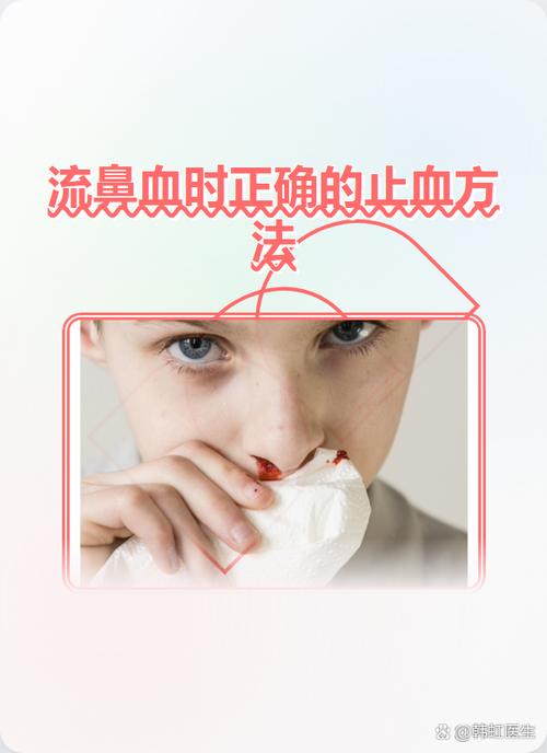 流鼻血吃糖有用吗