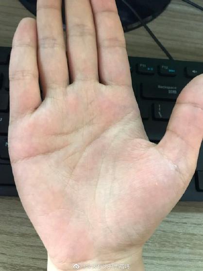 男生感情线断开2段错位平行