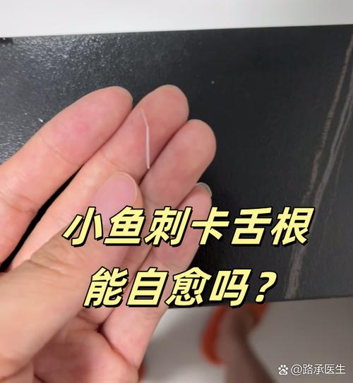 鱼刺扎在舌根部,取不出来了,怎么办