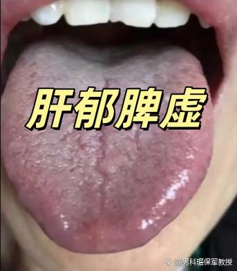 男人脾虚影响性功能吗