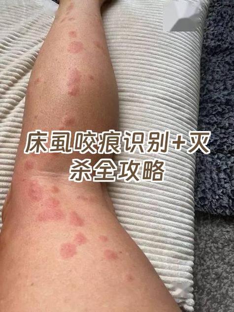 iphone使用痕迹清除缩略图