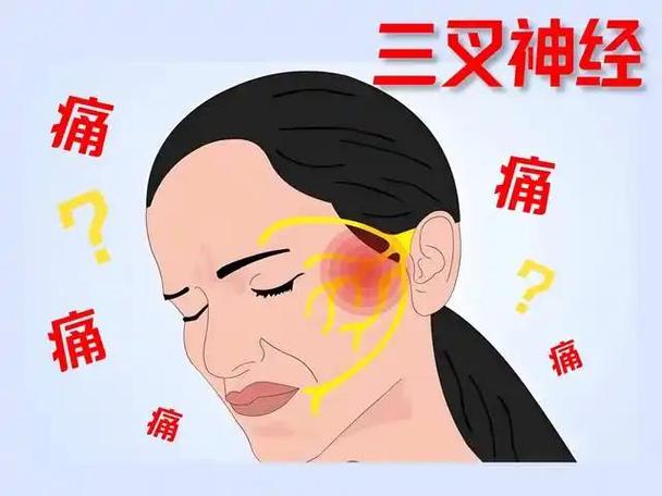 一侧面部疼痛