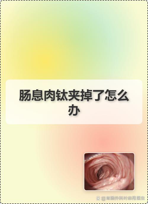 风干肠放冷藏还是冷冻
