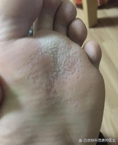 脚部痒痒是什么原因