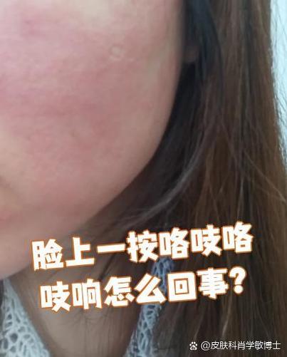 脸上一按咯吱咯吱响怎么回事截图