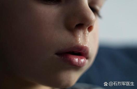 鼻涕自己流出来和清水一样