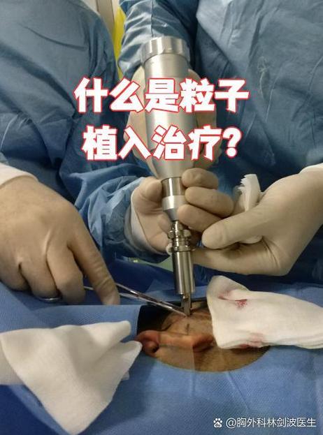 什么是粒子植入