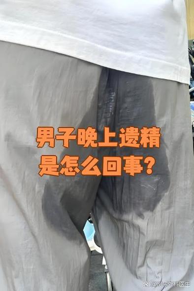 身体没有不适为什么男士内裤里面变