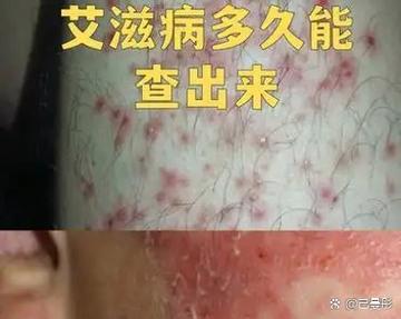 艾滋病抗体无反应是什么意思