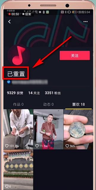 重置抖音账号