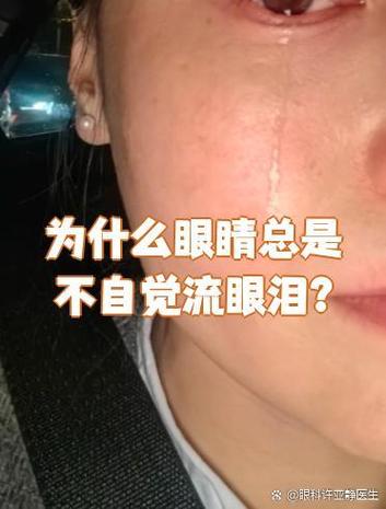 眼睛总是不自觉流眼泪图标