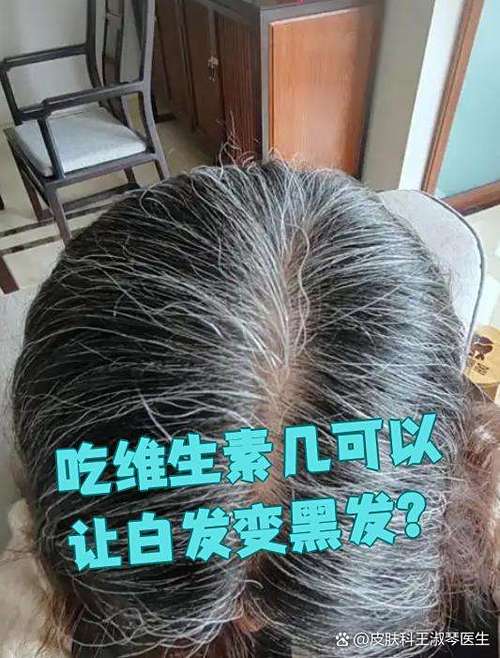 头发白吃什么变黑的最佳方法图标
