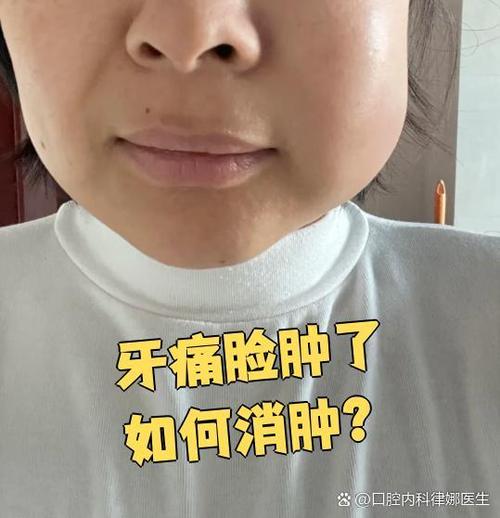 先是牙疼然后脸肿了