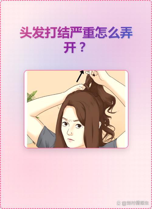 头发打结擦快速解开
