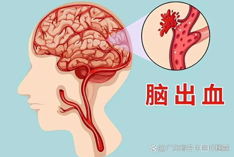 想事情感觉大脑像堵了一样缩略图