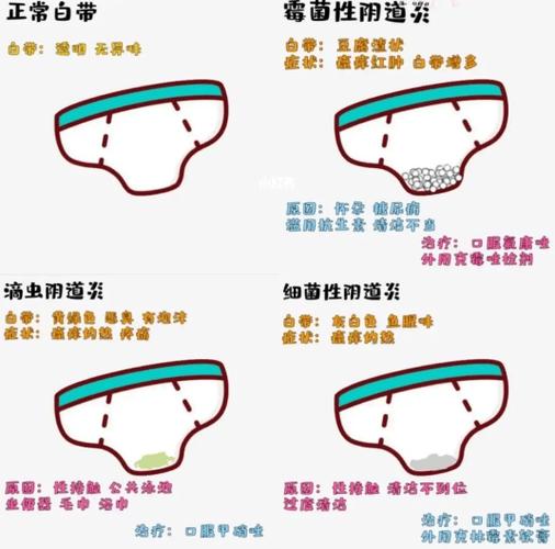 好多白色分泌物是怎么回事